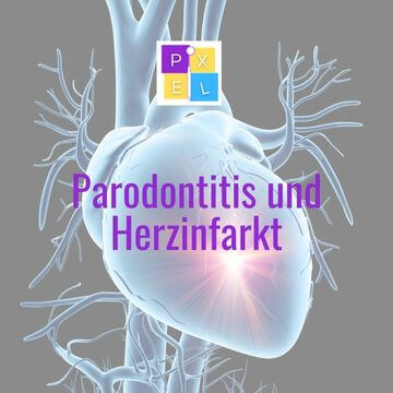 PIXEL.dental Shop Parodontitis und Herzinfarkt