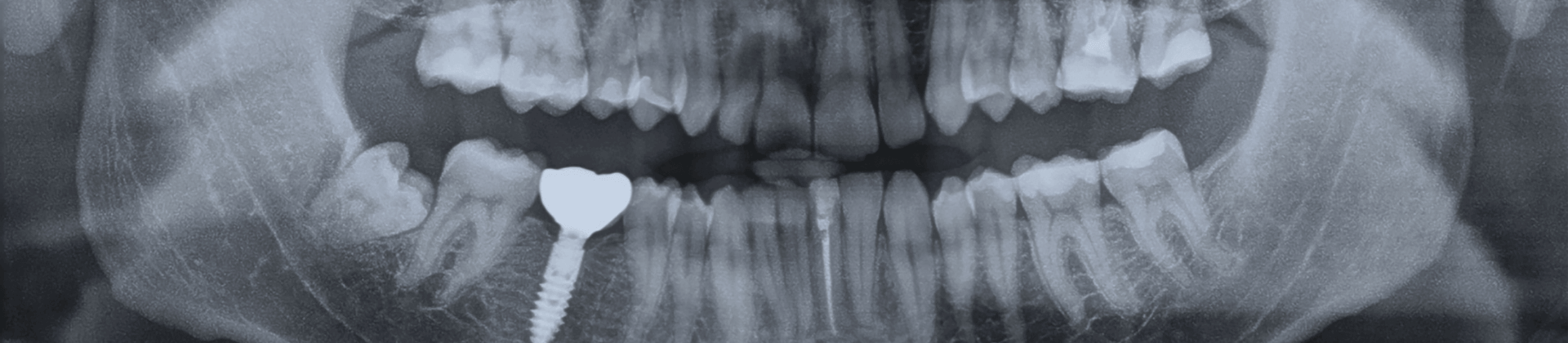 Zahnarztpraxis Röntgen Röntgenschutz Dental 