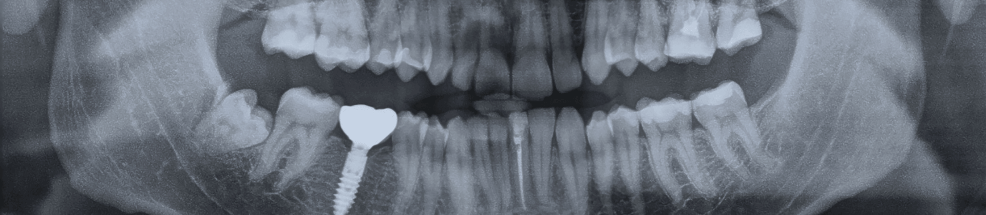 Zahnarztpraxis Röntgen Röntgenschutz Dental