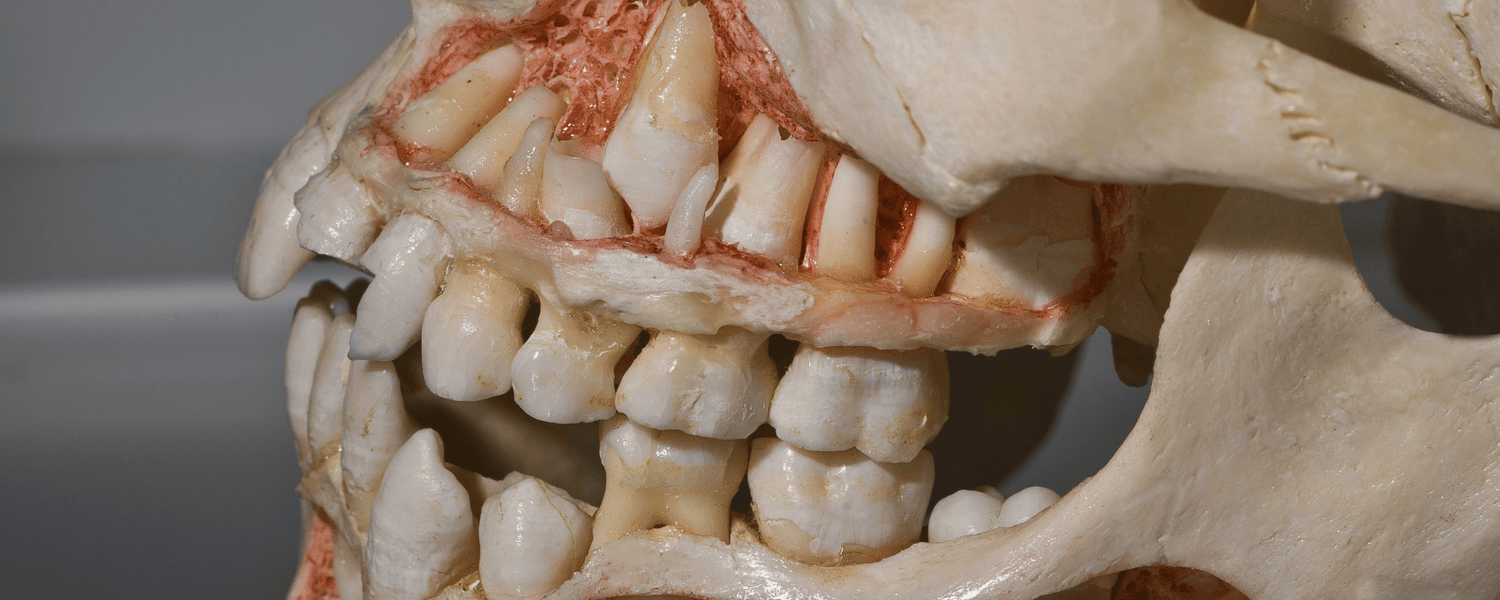 Knochenersatzmaterial Zahnmedizin in der oralen Implantologie