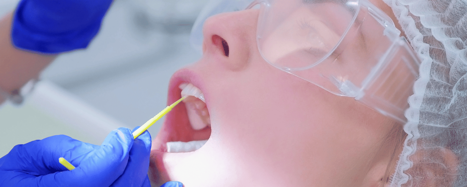 Fluoridgel Zahnarzt: nützlich oder nicht?