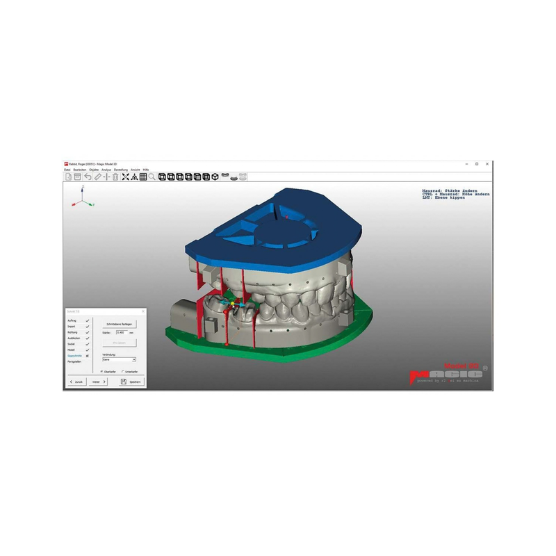 Magic® Model 3D, Dental CAD-Modelbuilder inkl. 3D Arti Add-On