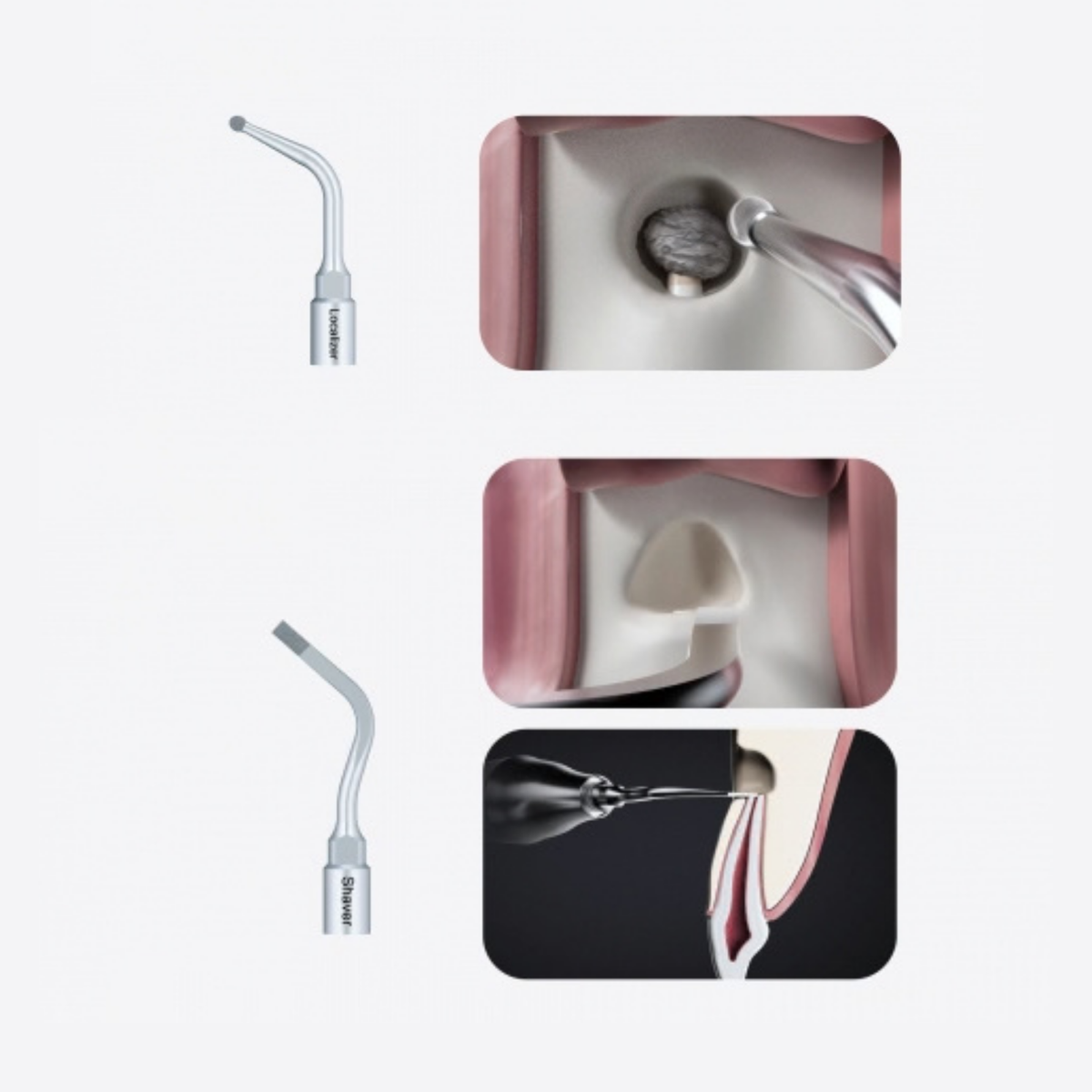 Altaqi Kit- Piezo-Endochirurgie für das WOODPECKER®-System zur Piezo-Knochenchirurgie