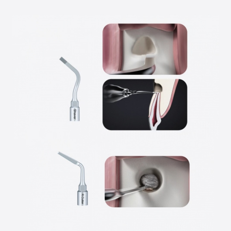 Altaqi Kit- Piezo-Endochirurgie für das WOODPECKER®-System zur Piezo-Knochenchirurgie