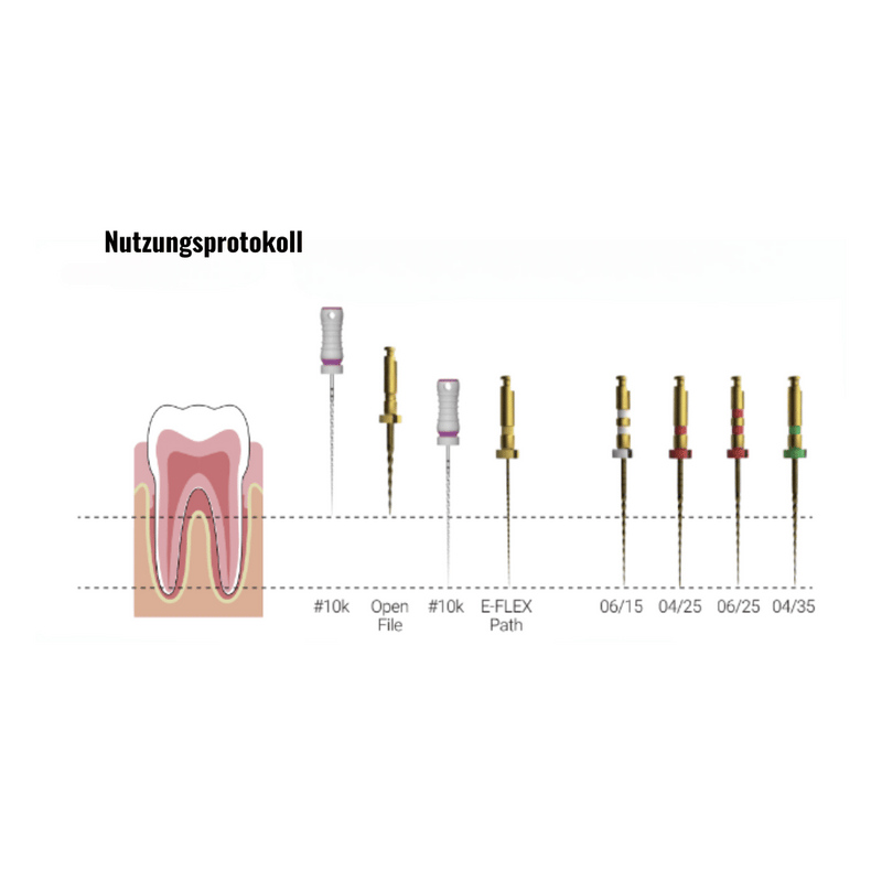 E-Flex Wurzelkanalinstrument NiTi