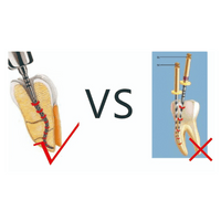 SC-PRO NiTi Endo Feile Wurzelkanalinstrument_6
