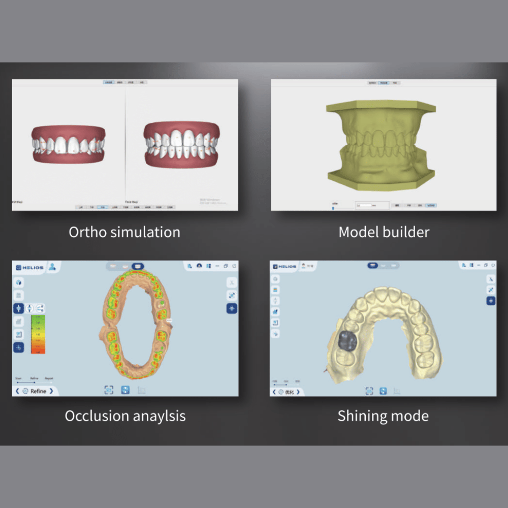 Helios 680 | Intraoral Scanner von Eighteeth