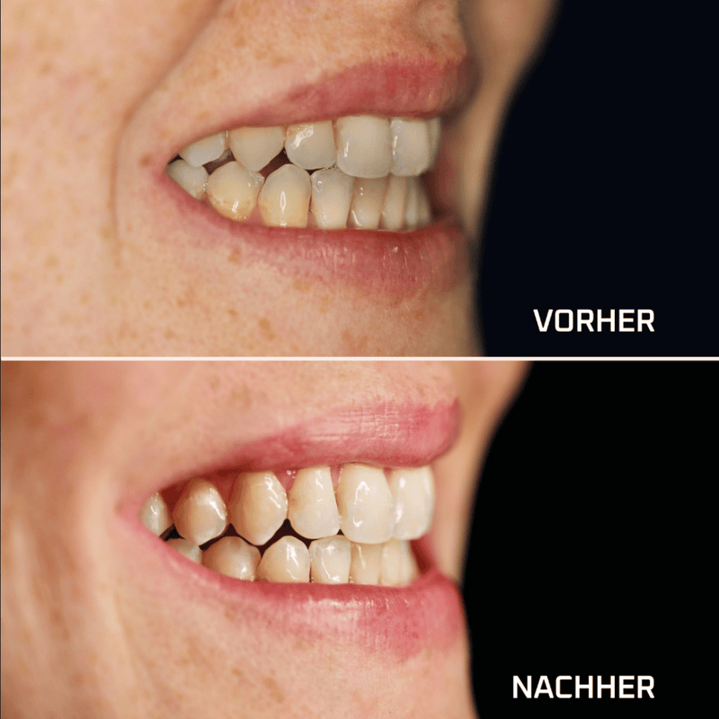 ManiShine MA-100688_2