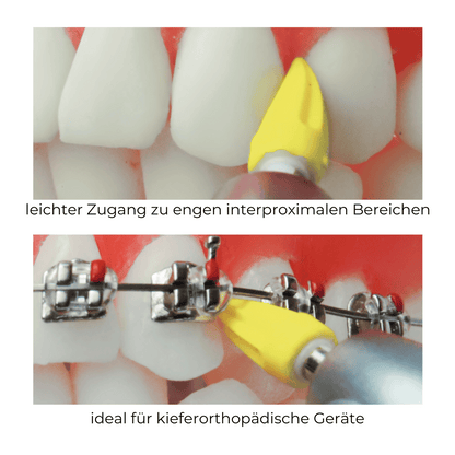 Polierspitze Prophylaxe Spitze Silikon Screw-In-PP-226RA_3