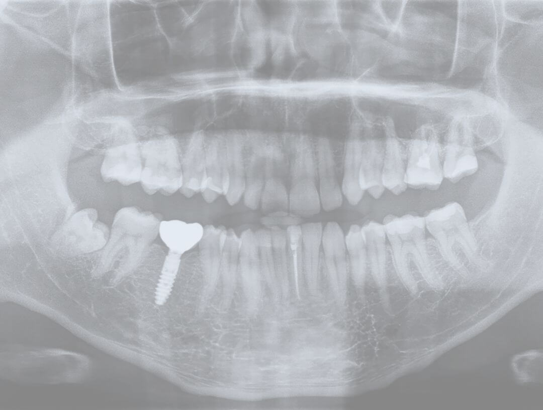 Röntgen Zahnarztpraxis Röntgenschutz dental Mobile