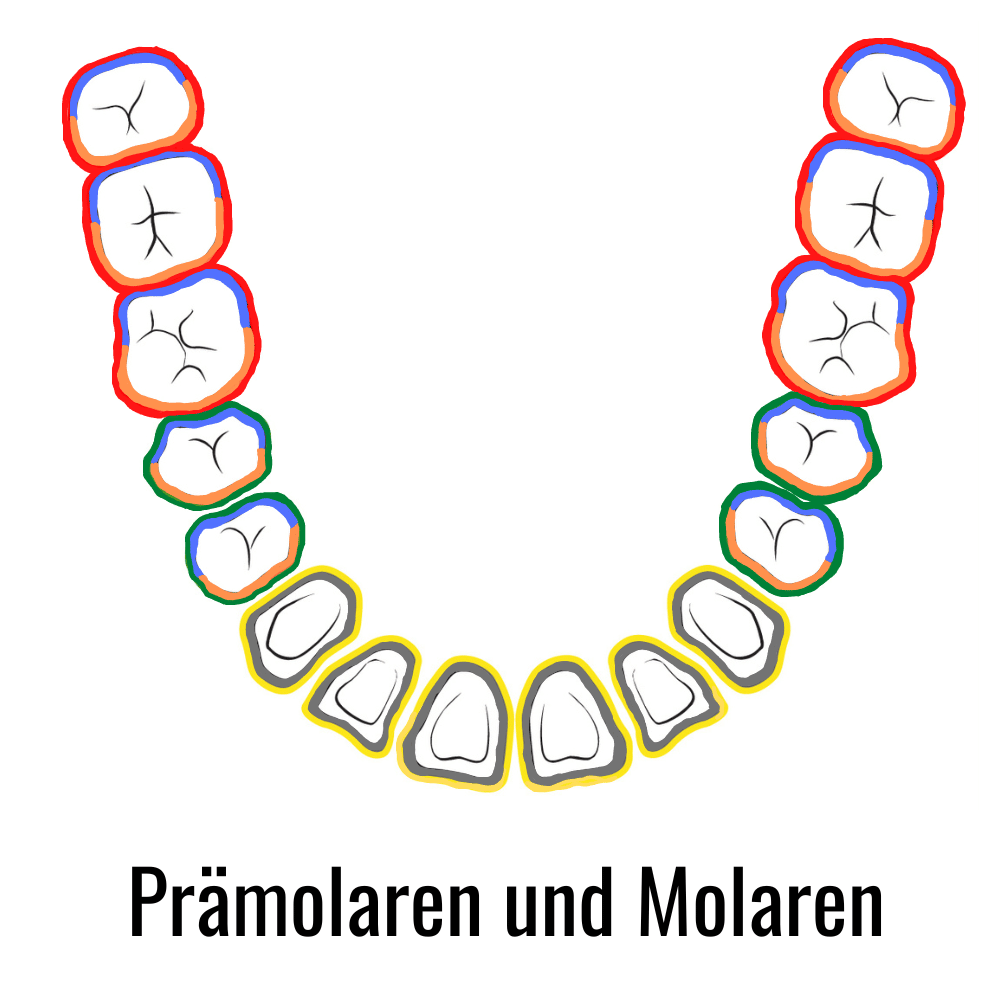 Gracey Küretten pramolar molar Zähne Parodontologie-RC-7001_6
